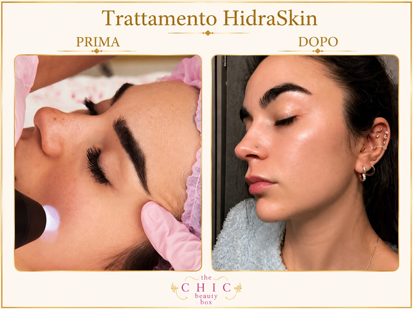 Prima e dopo: HydraSkin