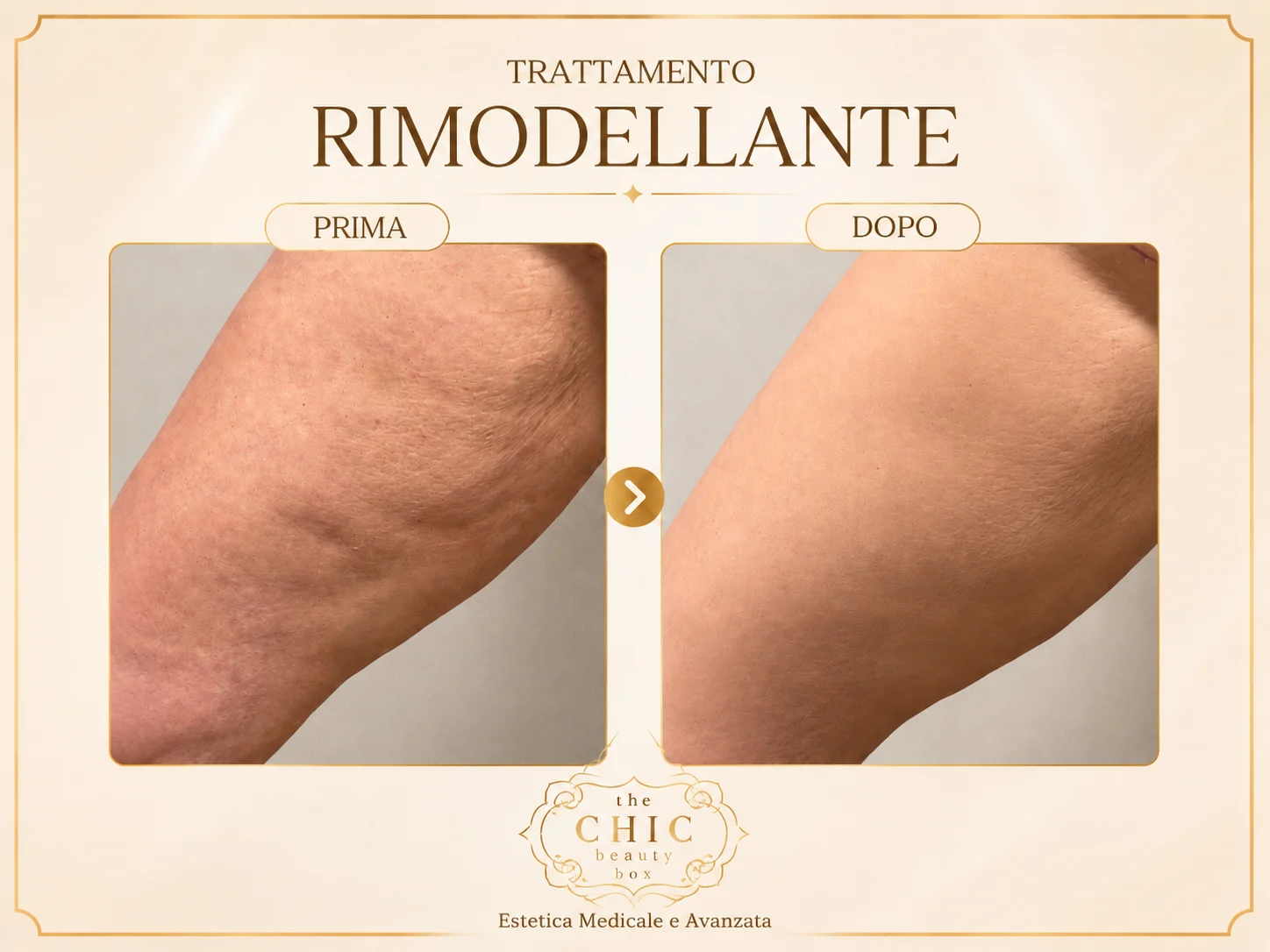 Prima e dopo: Rimodellante