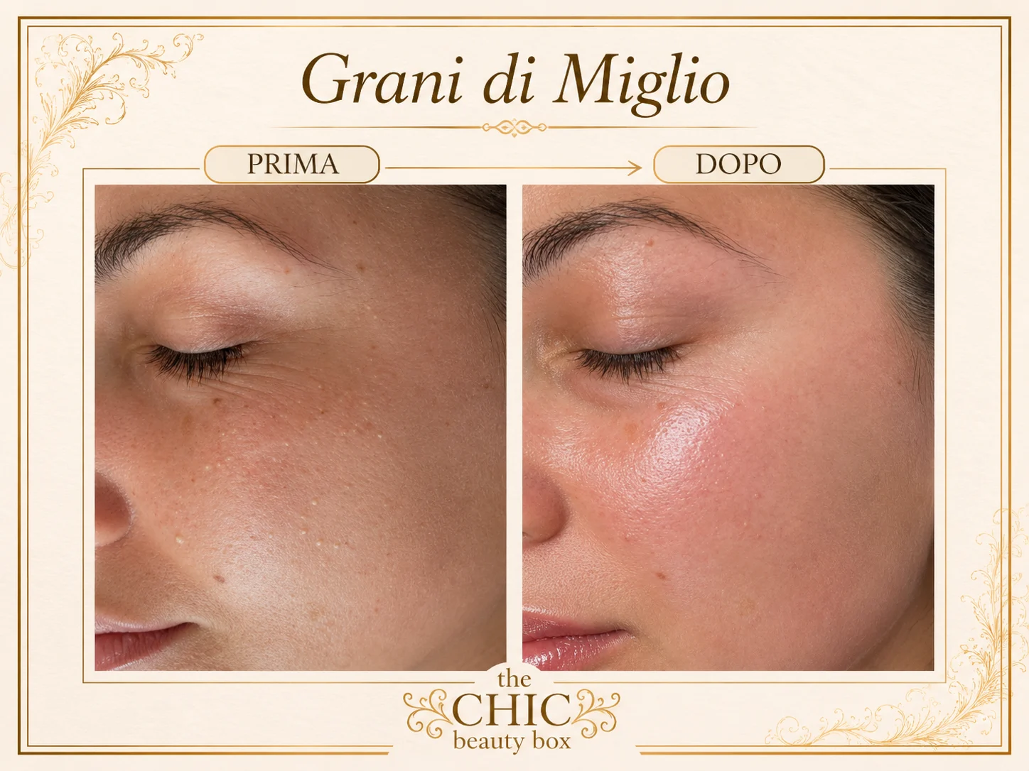 Prima e dopo: Grani di miglio