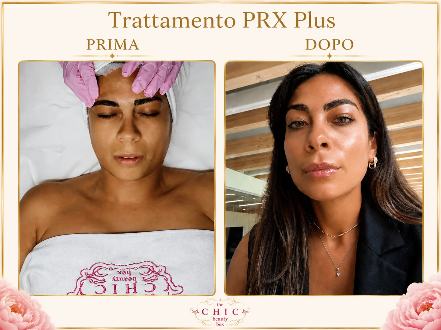 Prima e dopo: PRX Plus