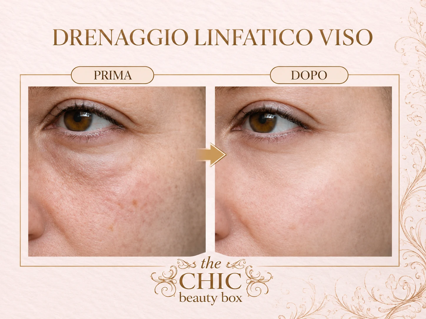 Prima e dopo: Drenaggio linfatico viso